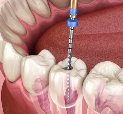 Dental Examination